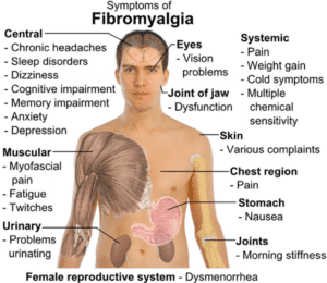 Fibromyalgia effects long term health